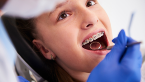 Read more about the article أقساط تقويم الأسنان في الرياض 2025 | خطط مرنة بدون فوائد مع عيادات أملدان