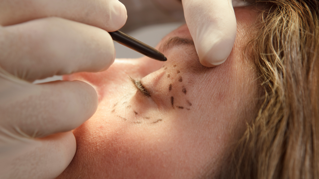 جراحات التجميل فى الرياض