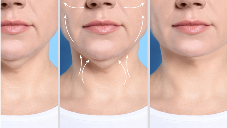 حقن الدهون الذاتية في الرياض