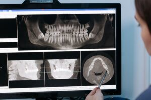 Read more about the article ليش صارت تكلفة زراعة الأسنان في الرياض من أكثر الأسئلة الشائعة التي يبحث عنها المراجعين؟