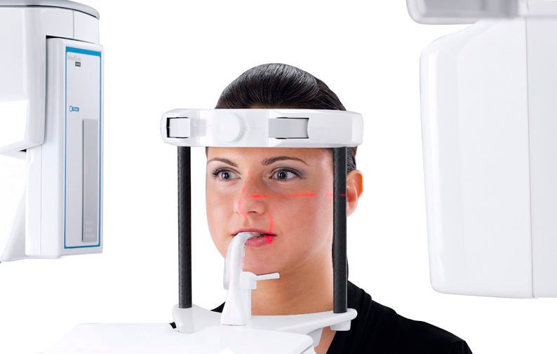 اشعة البانوراما سفالومتري