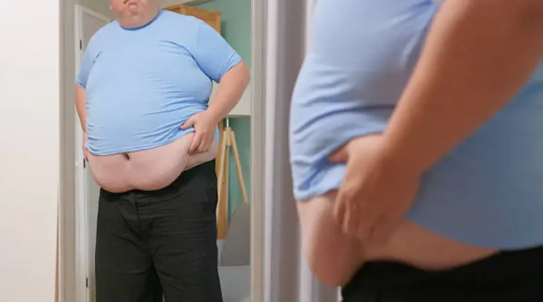 هل شفط البطن يساعد على التخلص من الكرش